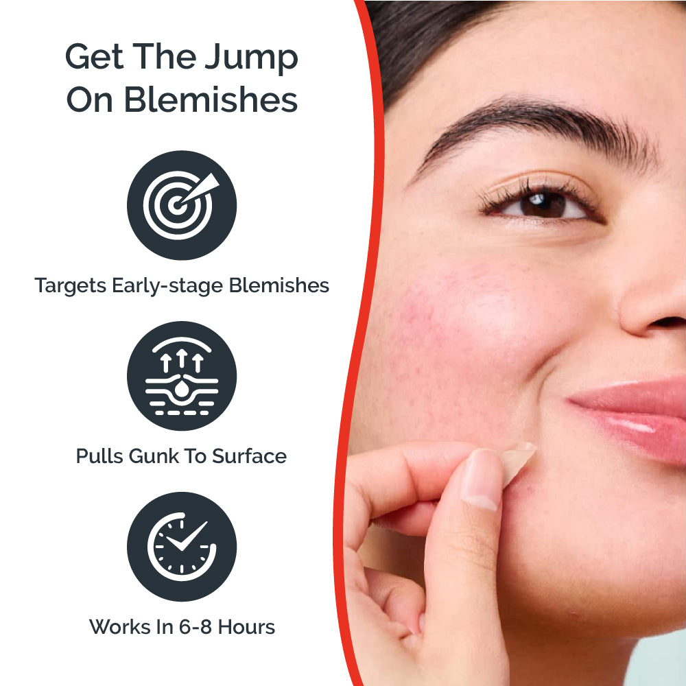 LIT ZIT Microneedle Blemish Patches - Fast-Acting Acne Patches for Face