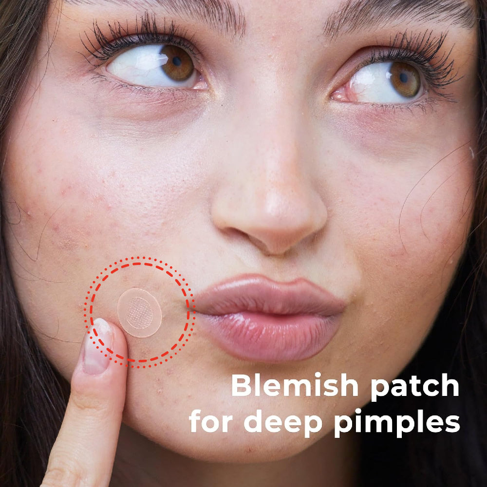 LIT ZIT Microneedle Blemish Patches - Fast-Acting Acne Patches for Face