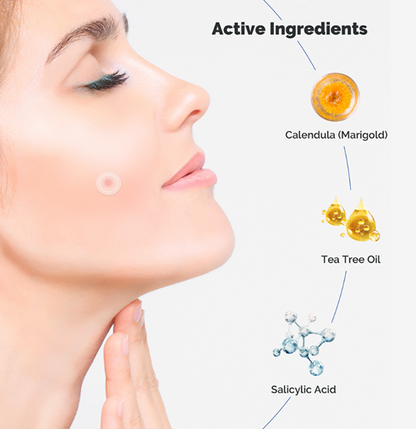 LITZIT Hydrocolloid Acne Patches
