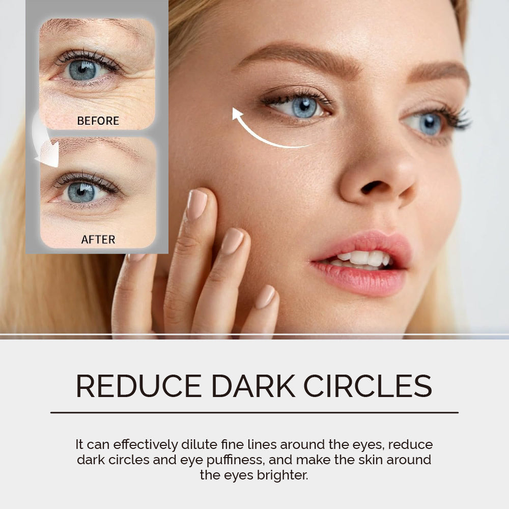 Microneedle Patches – Undereye, Forehead, Crow’s Feet & Smile Lines Treatment Pack of 4